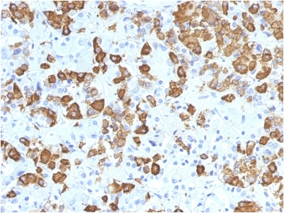FFPE human pituitary sections stained with 100 ul anti-Growth Hormone (clone GH/1371) at 1:50. HIER epitope retrieval prior to staining was performed in 10mM Citrate, pH 6.0.